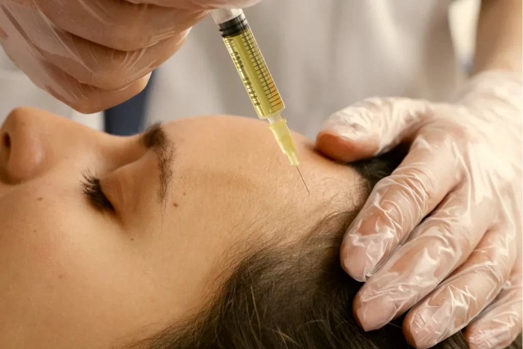 PRP platelet-rich plasma injection being administered to woman face for skin rejuvenation